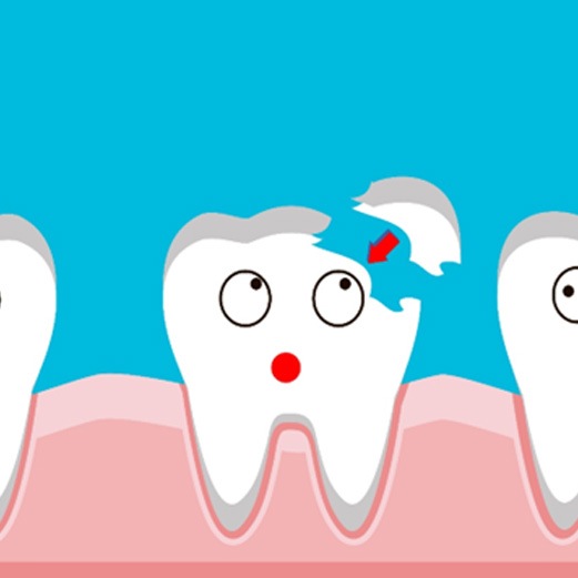 Chipped tooth being repaired