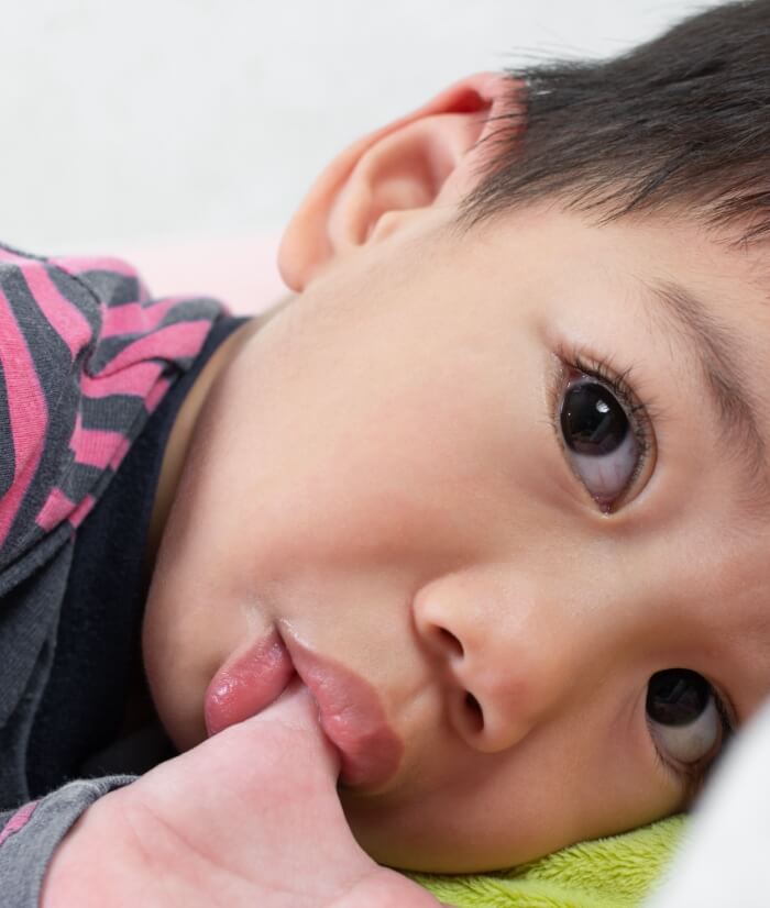 Child sucking thumb engaging in non-nutritive habits