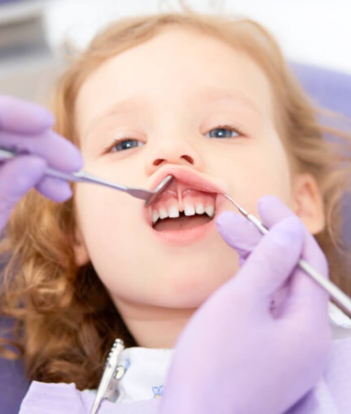 Dentist examining child in need of lip and tongue tie treatment