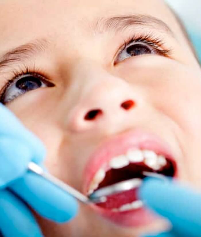 Child receiving silver diamine fluoride treatment