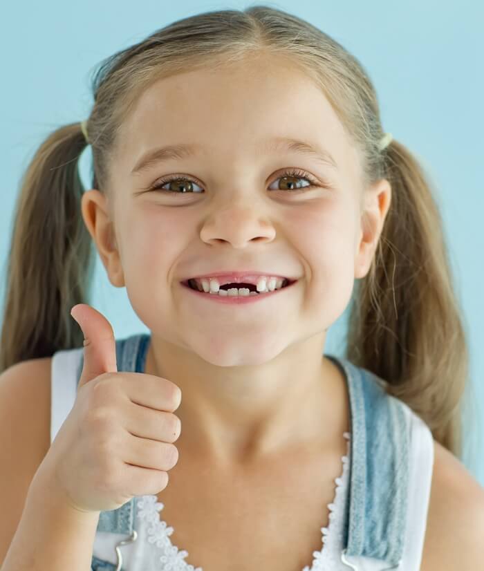 Child smiling with top front teeth missing after extraction