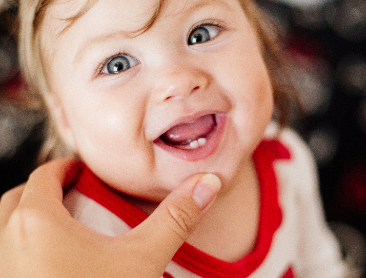 Baby with missing teeth